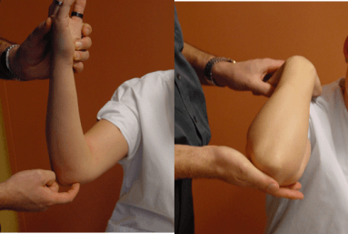 Inklemming (entrapment) van de nervus - Krachtverlies - Inklemming een zenuw - Elleboog - Orthopedie Herentals